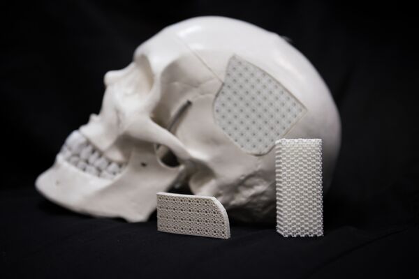 Los implantes fabricados por científicos rusos - Sputnik Mundo