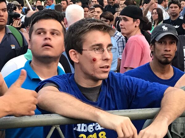 Un manifestante que recibió el impacto de una bala de goma en la cara - Sputnik Mundo