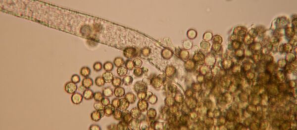 Muestras de aflatoxinas, una peligrosa sustancia capaz de provocar cáncer (imagen referencial) - Sputnik Mundo