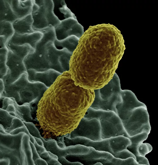 Crean el primer 'mapa de bacterias' en el mundo para poder combatirlas Crean el primer 'mapa de bacterias' en el mundo para poder combatirlas - Sputnik Mundo