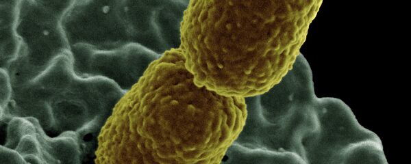 Klebsiella pneumoniae, una bacteria que provoca infecciones importantes. - Sputnik Mundo