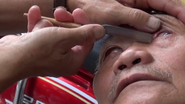 ¡Hazte un original 'peeling' ocular! Un barbero utiliza un cuchillo para limpiar los ojos - Sputnik Mundo