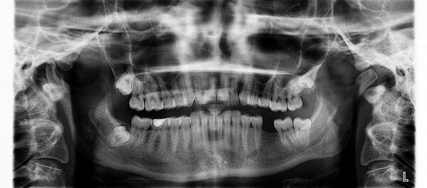 Rock 'n' roll en los huesos - Sputnik Mundo