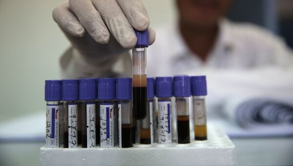 Análisis de sangre en Yemen (imagen referencial) - Sputnik Mundo