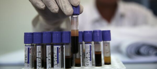 Análisis de sangre en Yemen (imagen referencial) - Sputnik Mundo