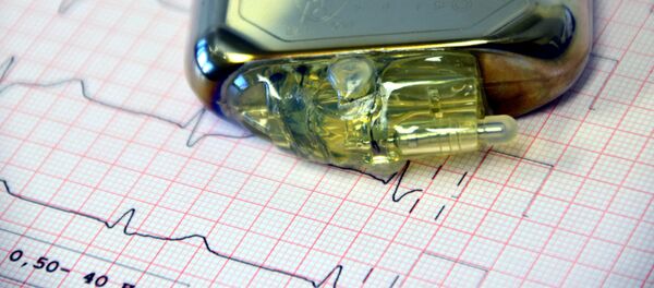 Un marcapasos - Sputnik Mundo