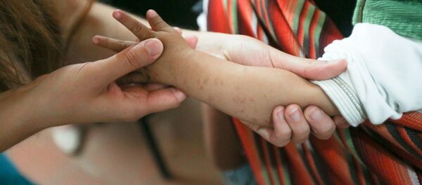 Los voluntarios de Health&Help en Nicaragua Los voluntarios de Health&Help en Nicaragua - Sputnik Mundo