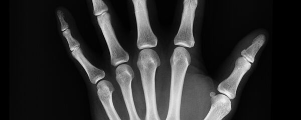 Huesos humanos - Sputnik Mundo