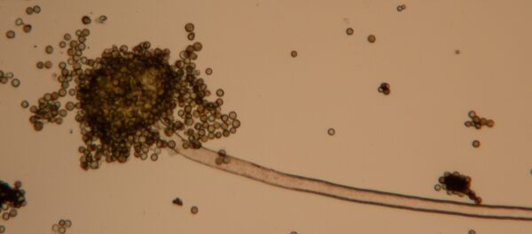 Un hongo bajo microscopio - Sputnik Mundo