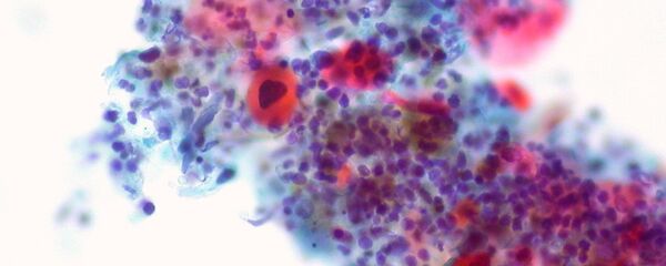Células de cáncer (imagen referencial) - Sputnik Mundo