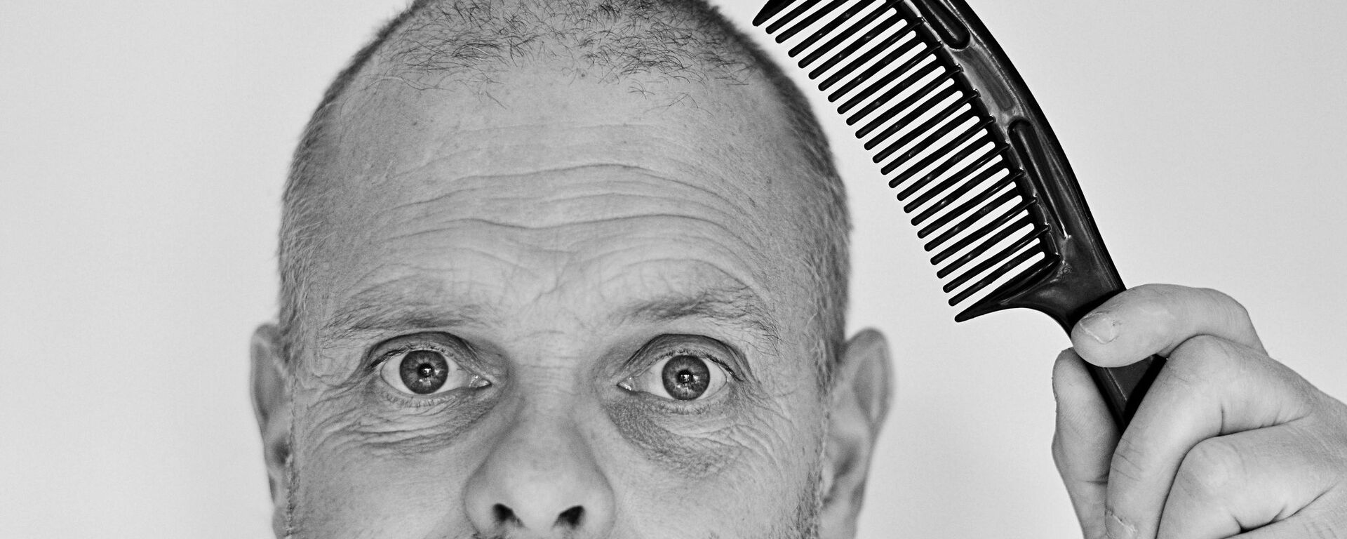 Un hombre con poco pelo (imagen ilustrativa) - Sputnik Mundo, 1920, 02.07.2022