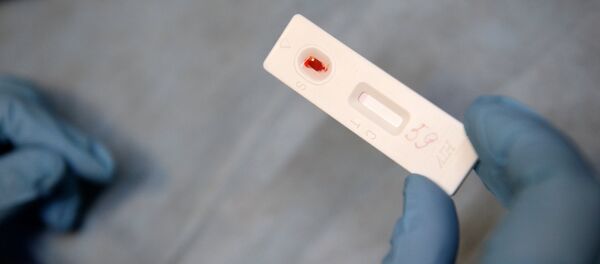 Una analisis de sangre para detectar el VIH Una analisis de sangre para detectar el VIH - Sputnik Mundo