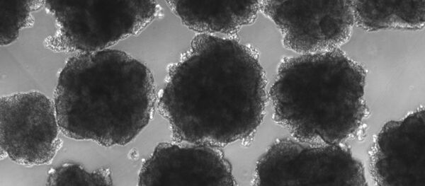 Microcerebro creado por Muotri bajo el microscopio Microcerebro creado por Muotri bajo el microscopio - Sputnik Mundo