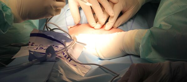 Cirugía, imagen referencial - Sputnik Mundo
