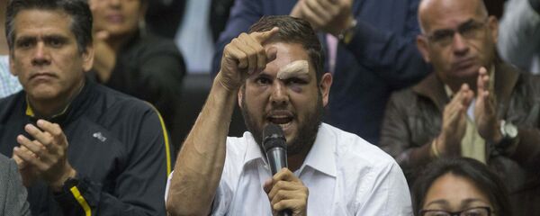 Juan Requesens, diputado venezolano (archivo) - Sputnik Mundo