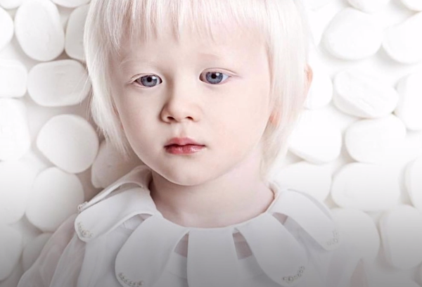 Estos hermanos tienen algo peculiar: son albinos Estos hermanos tienen algo peculiar: son albinos - Sputnik Mundo