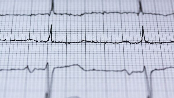 Un cardiograma (imagen referencial) - Sputnik Mundo