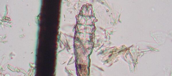 Un ácaro Demodex, imagen referencial - Sputnik Mundo
