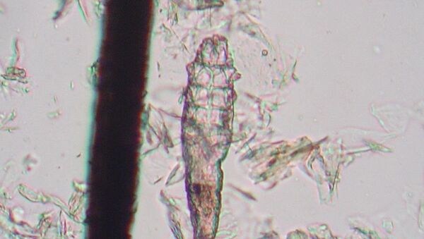 Un ácaro Demodex, imagen referencial - Sputnik Mundo