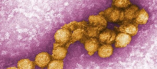 El virus del Nilo Occidental - Sputnik Mundo