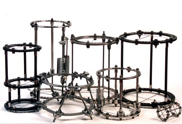 Aparatos Ilizárov - Sputnik Mundo