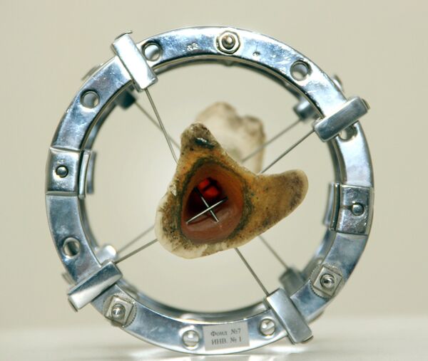 Aparato Ilizárov - Sputnik Mundo