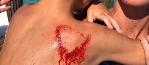 Un padre libera a su hijo de las mandíbulas de un tiburón - Sputnik Mundo