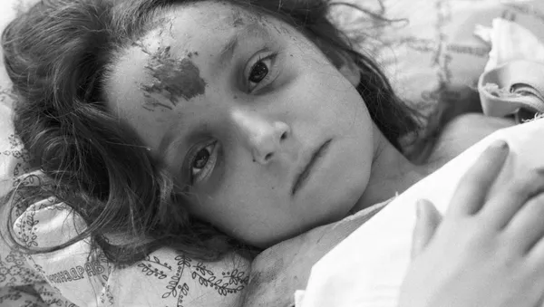 Niña herida durante el sismo de Spitak en un hospital de Moscú (archivo) - Sputnik Mundo