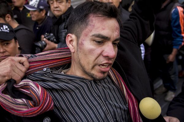  Lesionado por policías de la Ciudad habla con la prensa tras lo sucedido - Sputnik Mundo