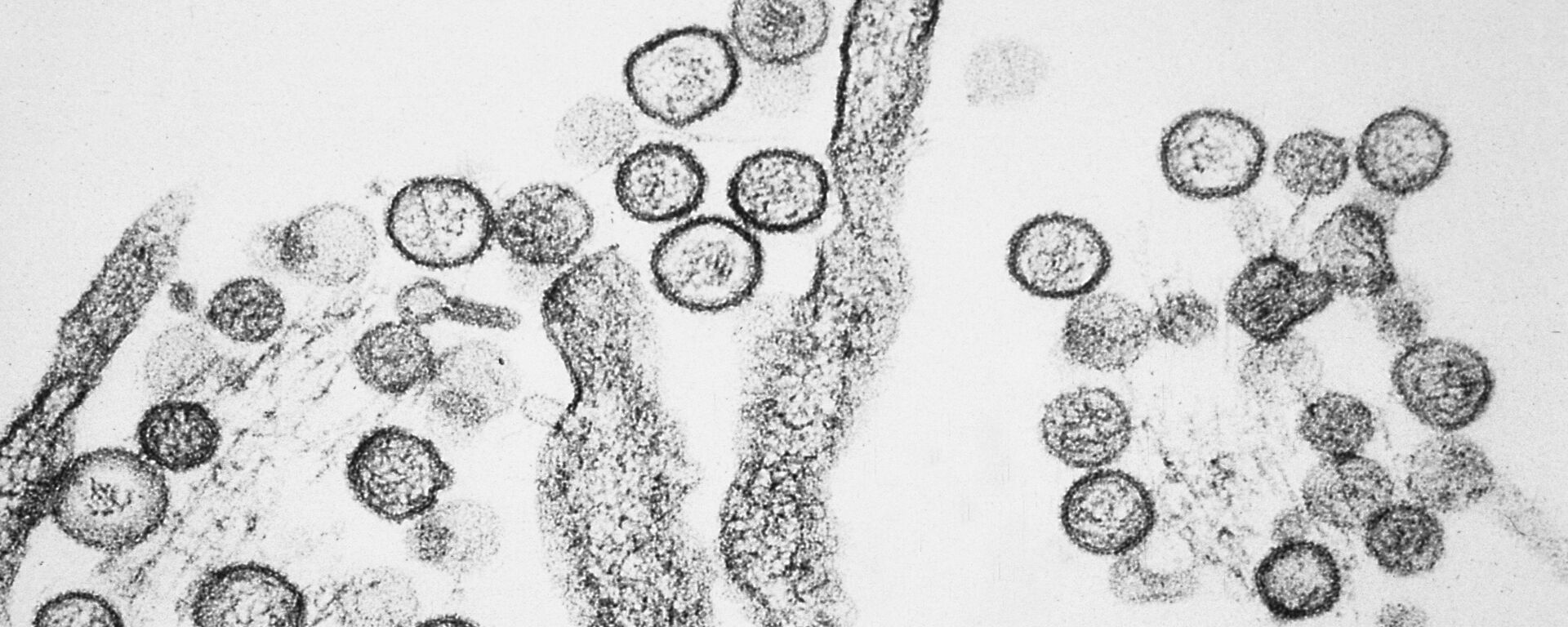 Hantavirus (imagen referencial) - Sputnik Mundo, 1920, 08.06.2021