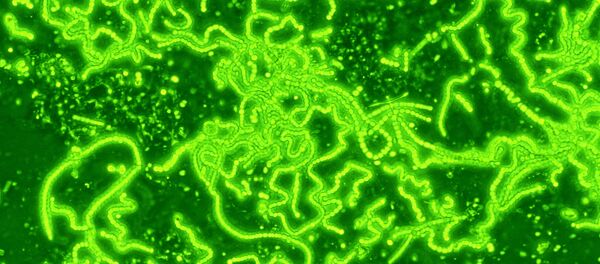 Cianobacterias (cyanobacterias) - Sputnik Mundo