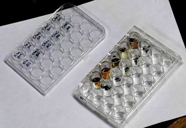 Los quelites tienen un importante aporte nutrimental: son ricos en micronutrientes, fibra, minerales y vitaminas; son económicos y son eficaces en el tratamiento contra la gastritis - Sputnik Mundo