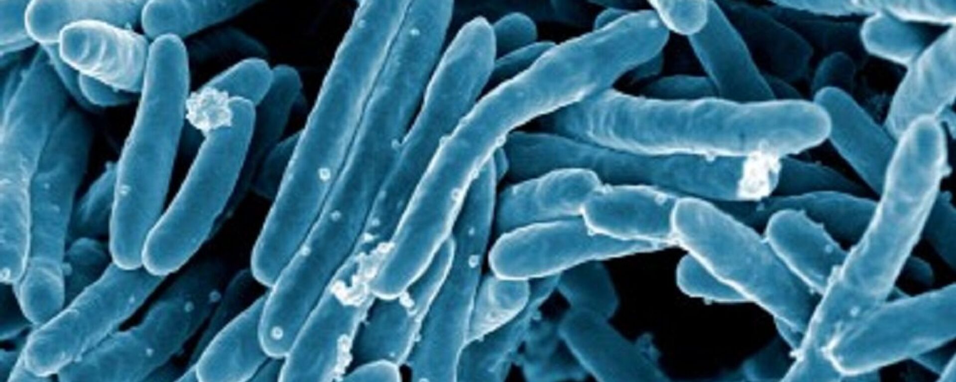 Mycobacterium tuberculosis - Sputnik Mundo, 1920, 15.10.2020