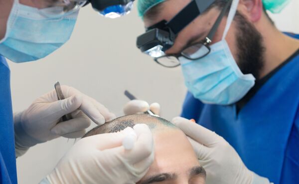 No es demasiado tarde: entérate de cómo puedes revertir la calvicie - Sputnik Mundo