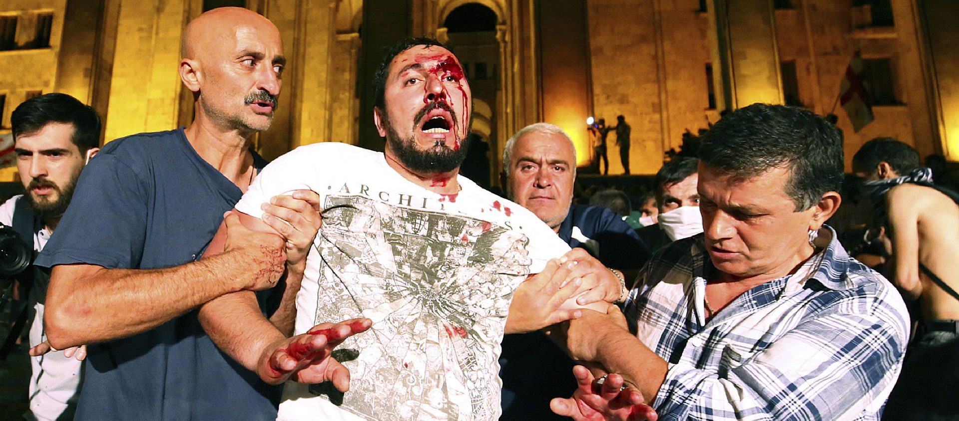 Manifestantes ayudan a un hombre herido durante las protestas en Tiflis Manifestantes ayudan a un hombre herido durante las protestas en Tiflis - Sputnik Mundo, 1920, 25.06.2019