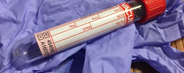 Experimento médico, referencial - Sputnik Mundo