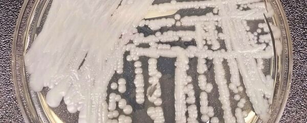 Candida auris - Sputnik Mundo