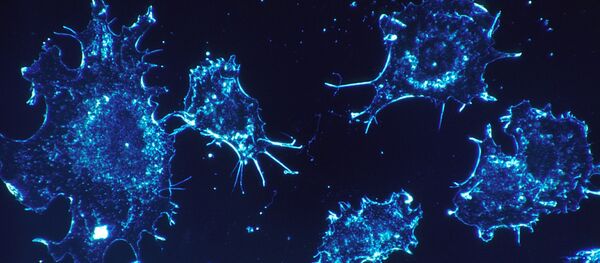 Las células cancerosas en una imagen  - Sputnik Mundo