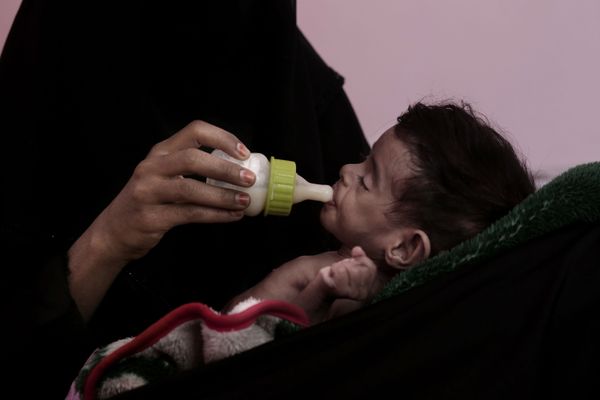 Uno de cada tres niños menores de 5 años padece malnutrición - Sputnik Mundo