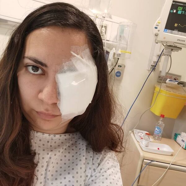 Enfermera chilena relata disparo de la policía que la dejó con un estallido ocular - Sputnik Mundo