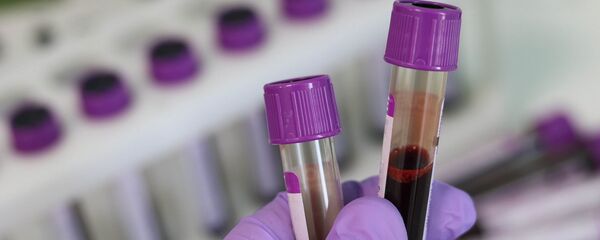 Muestra de sangre en laboratorio médico - Sputnik Mundo