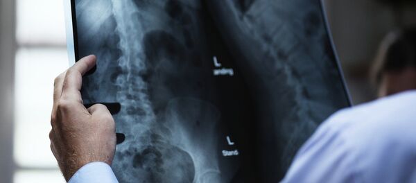 Una radiografía - Sputnik Mundo