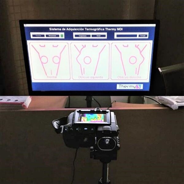 Descubren un método más efectivo que la mamografía para detectar el cáncer de mama - Sputnik Mundo