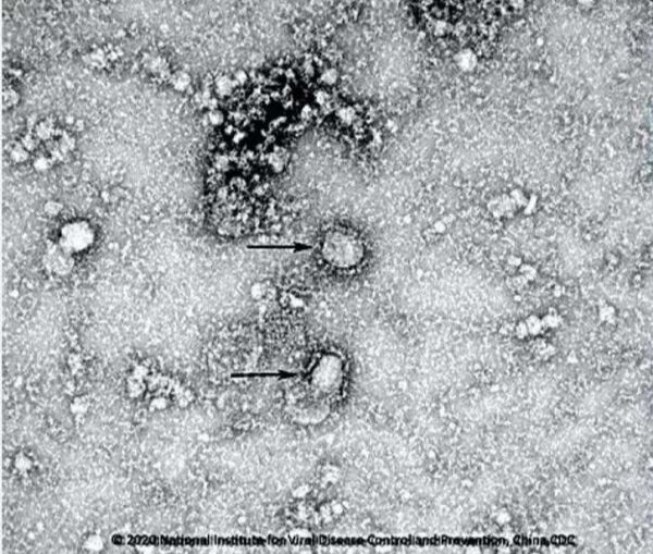 China publica la primera imagen del coronavirus - Sputnik Mundo