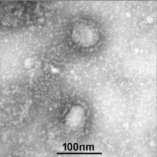 China publica la primera imagen del coronavirus - Sputnik Mundo