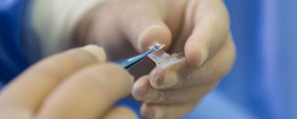 Tratamiento médico (imagen referencial) - Sputnik Mundo