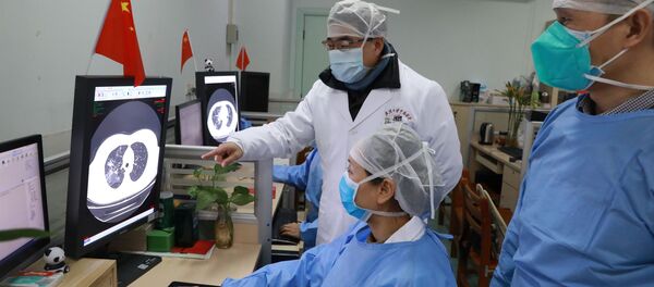 Médicos del hospital de Zhongnan en Wuhan observando la tomografía de un paciente  - Sputnik Mundo