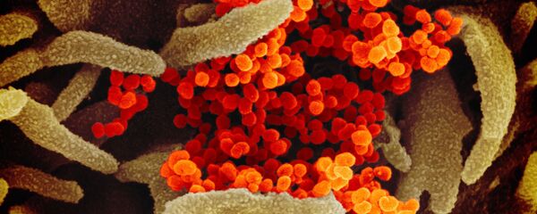 Imagen en color y alta resolución del SARS-CoV-2  - Sputnik Mundo