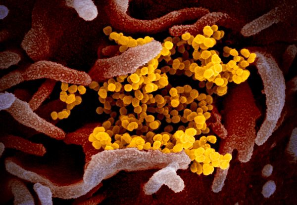 Publican fotos del coronavirus chino a color y en alta resolución Publican fotos del coronavirus chino a color y en alta resolución - Sputnik Mundo