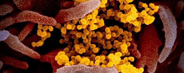 Imagen en color y alta resolución del SARS-CoV-2  - Sputnik Mundo